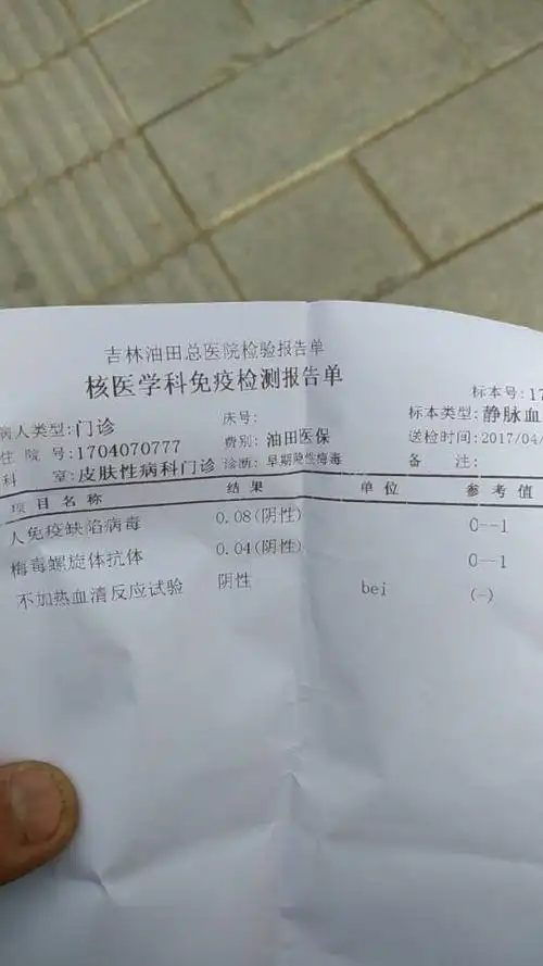 高危两周后检查的结果谁知道这是感染了艾滋病了吗?