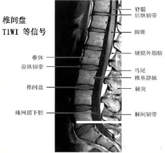 腰椎间盘的诊断与治疗