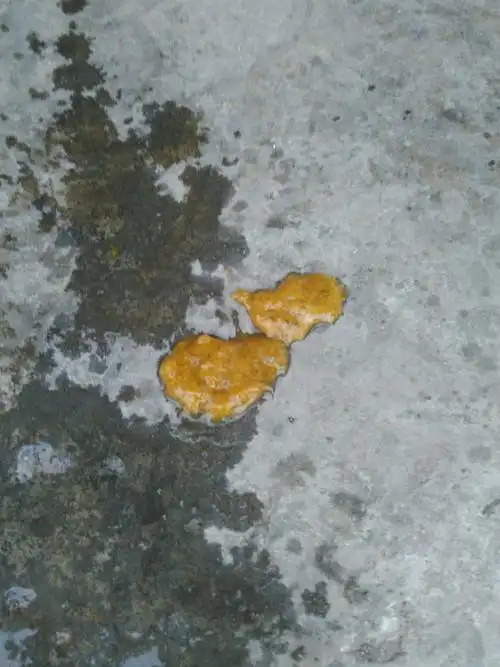 宝宝拉大便油油的.而且一天要拉好多次,请问怎么办谢谢