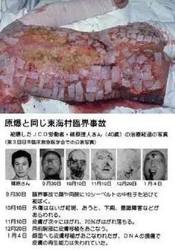 日本东海村核临界事故