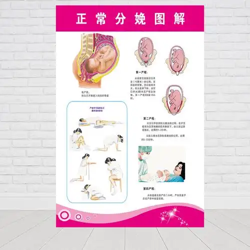 医院卫生制度文化妇产科胸膝卧位挂图走廊墙贴孕妇保健宣传画海报产科