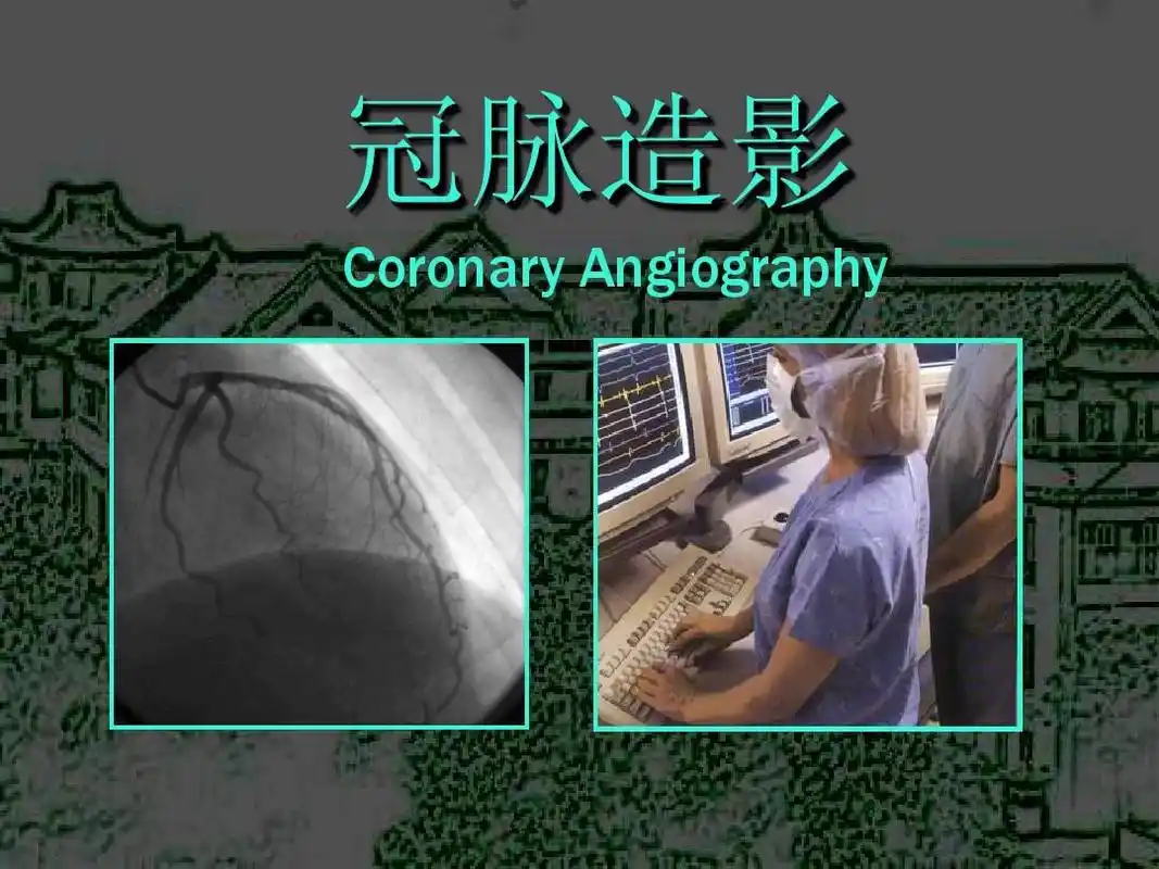 冠脉造影 coronary angiography