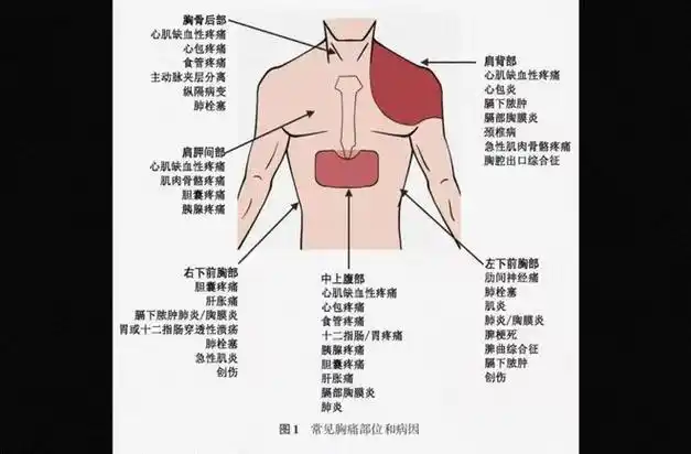 也就是说我们常常心肌梗死,其实还分很多种,嗯,有一种是彻底,一下子就