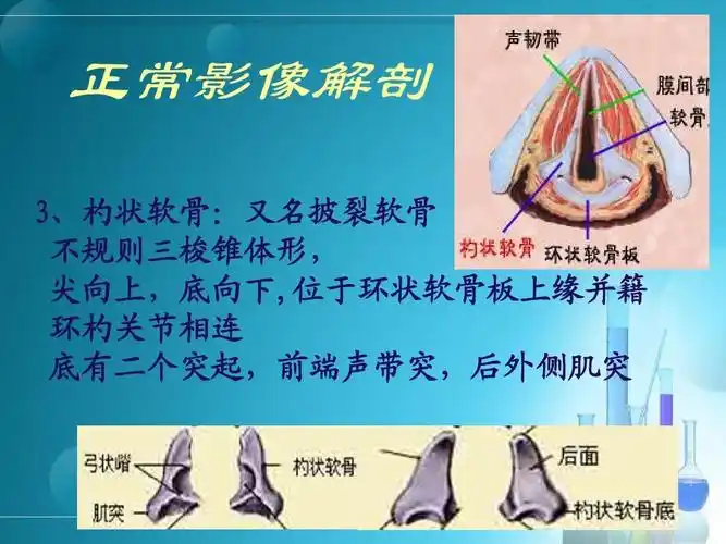 喉部疾病影像诊断  ct  mri 正常影像解剖 3,杓状软骨:又名披裂软骨