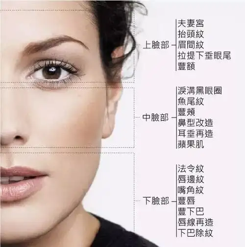 天生鼻唇沟深怎么办 玻尿酸帮你填充