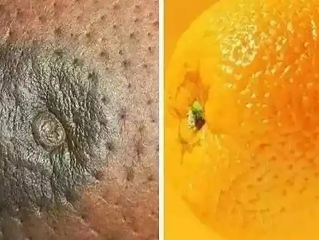 乳晕周围有小疙瘩,他们说这是毒素堆积|蒙氏|结节|乳晕_新浪新闻