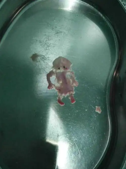 十周左右流产的胚胎. 图是知乎上保存的,侵删.