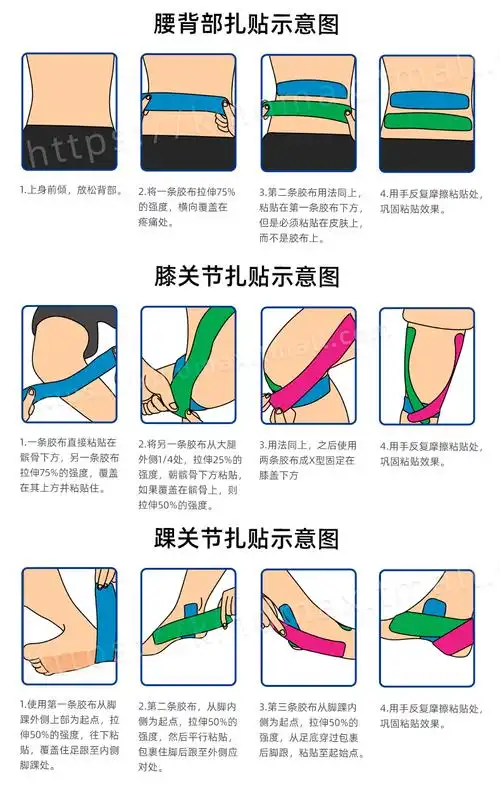 康玛士肌肉贴肌贴运动绷带肌内效贴布肌肉拉伤酸痛贴胶布胶带肤色38cm