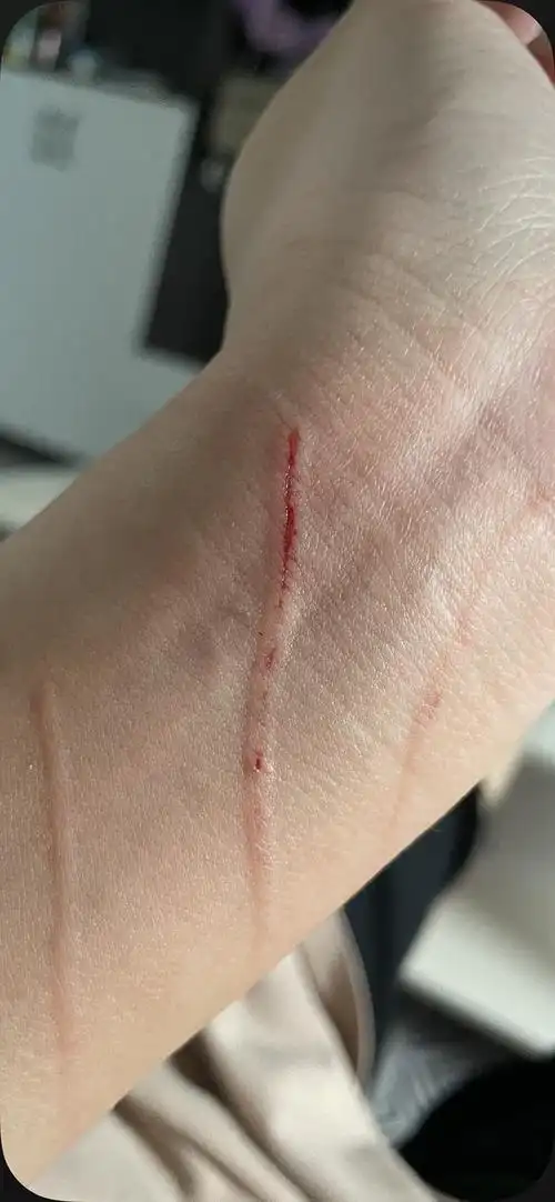 被猫抓破血需要打狂犬疫苗吗