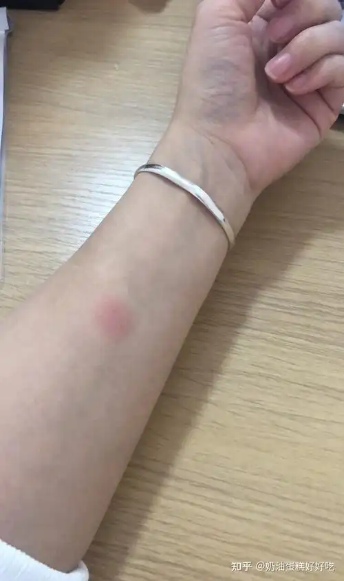 抗击结核小记录