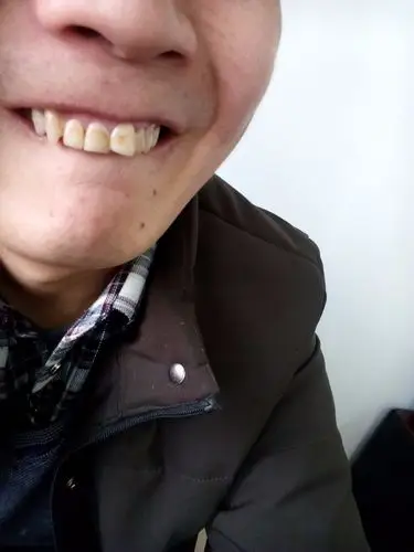 请懂得牙科医生看看,我有个门牙有点外突,不知道能不能弄弄,别再突了