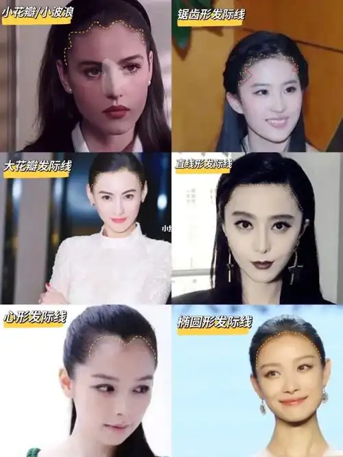 植发际线形状合集参考