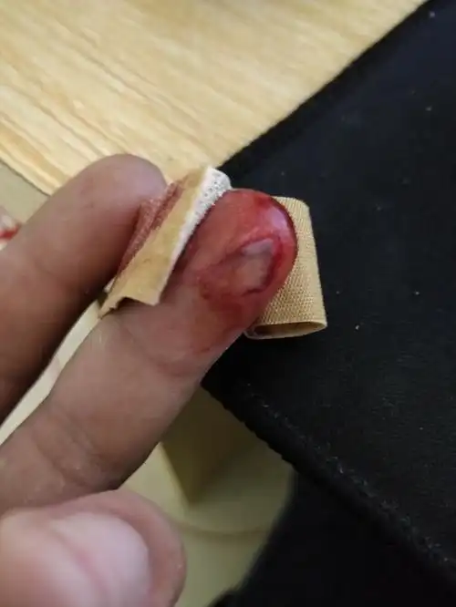 被玻璃割伤了手指.