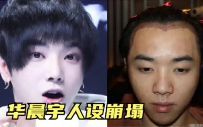 网曝华晨宇整容植发,素颜曝光差距太大,粉丝直呼接受不了
