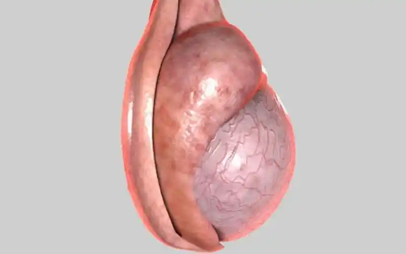 备孕前查出右侧附睾囊肿请问是什么意思