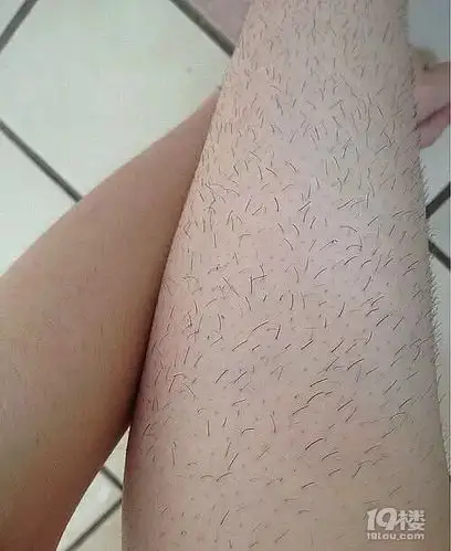 前方高能刮了十年腿毛结果腿上全是毛我可是女生啊
