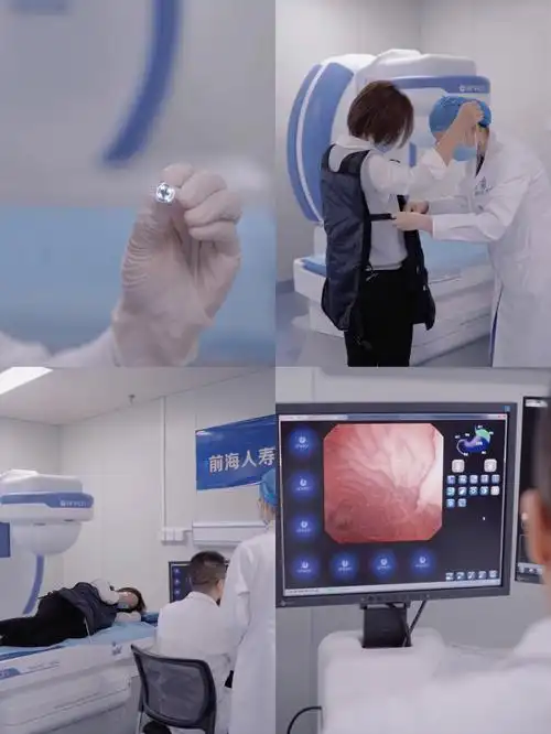 为了少受点罪,去做了磁控胶囊92胃镜!