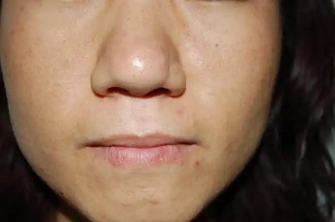 从而显得肌肤失去血色,脸色苍白,无光泽,皮肤粗糙,脸色萎黄,暗淡无光