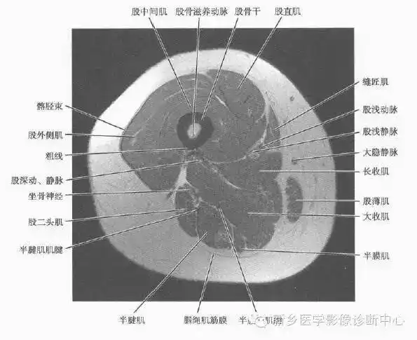 来源:骨骼肌肉mri ct断层解剖(第3版)本站是提供个人知识管理的网络