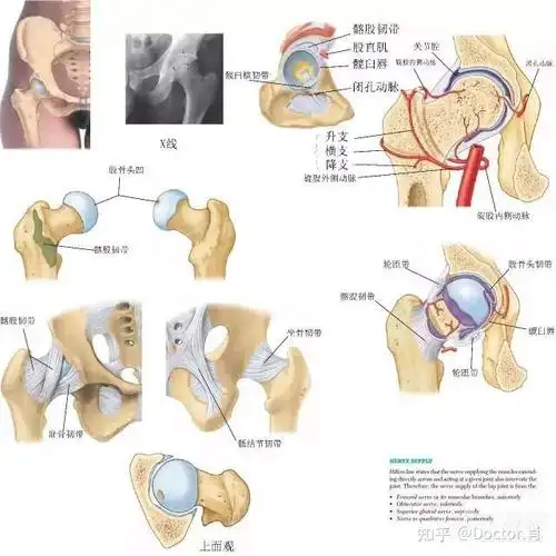 髋关节滑囊炎的症状表现是什么? - 知乎