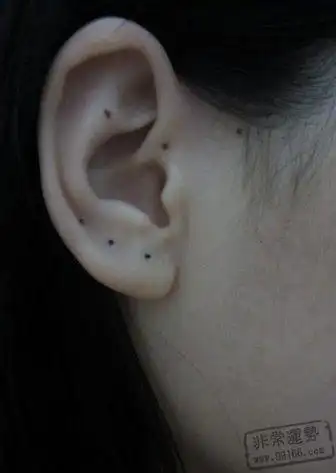 耳朵后长痣是否小人多