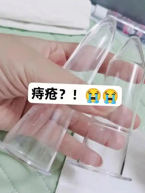 姐妹听我一句劝痔疮肉球真的要重视