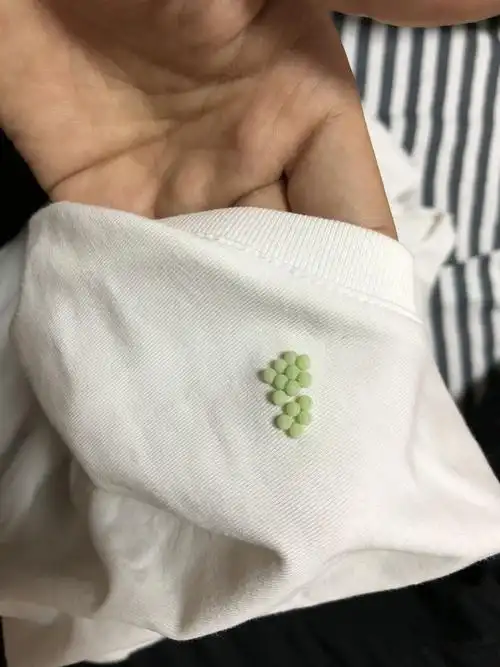 衣服上粘附的应该是虫卵,建议对衣物进行消毒清洗,衣物消毒液含高效