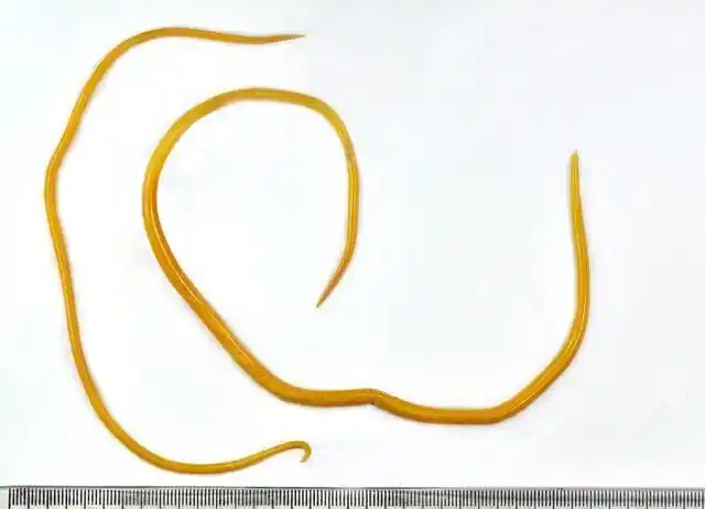 怎么判断人体该驱虫了(身体有蛔虫有什么表现)