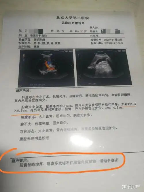 最后不得不做切除胆囊手术确诊胆结石加胆囊炎后面去做了检查经常疼到