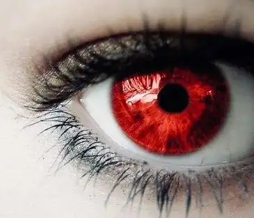 红眼睛
