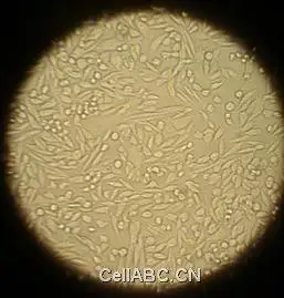 贴壁细胞传代消化过程图示