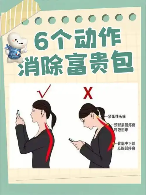 低头族必备6个动作消除富贵包