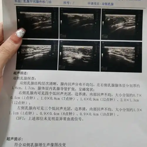 关于乳腺纤维瘤的记录