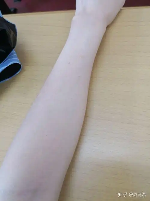 有一天我拿着相机照我的胳膊 不知道什么原因如图一出奇的白 可能是