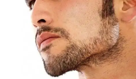 脱络腮胡多少钱