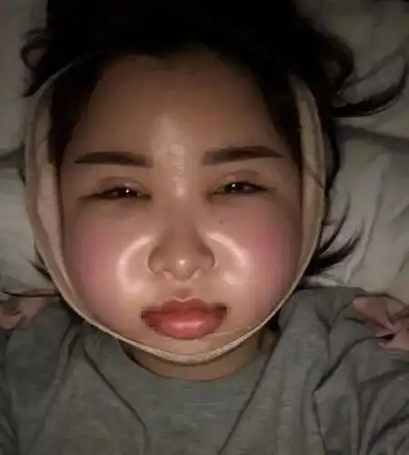 被亲爹嫌丑,21岁女孩花90万整容:得不到夸奖的孩子一生有多苦?