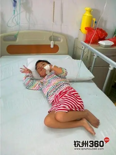 弱弱的问一声,这个脑瘫的小女孩能进福利院吗?