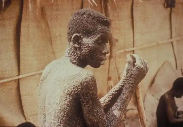 史上最致命的6大病毒排行榜,它们曾杀死数亿人!