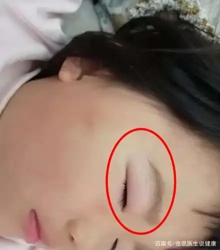 小孩眼睛有4个表现别忽视,脾胃八成已"烂如渔网",快给娃消积食