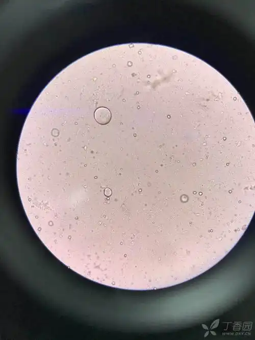 大便中的淀粉酶颗粒