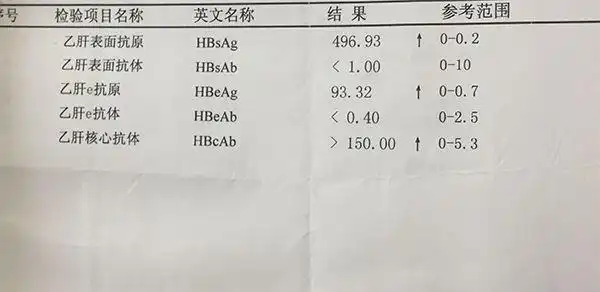 症状较为明显时,乙肝大三阳,如何把握体征调整饮食?