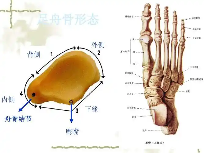 足舟骨形态 外侧 背侧 内侧 下缘 舟骨结节 鹰嘴