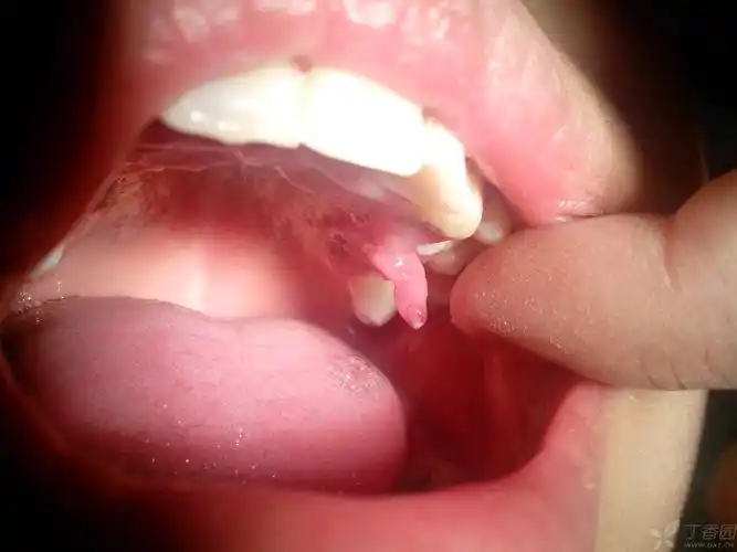 口腔 -丁香园论坛