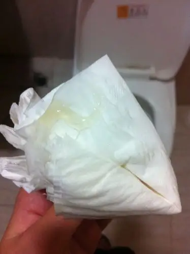 这是宫颈黏液吗?有这个大概多久会生?有经验的妈妈求告知