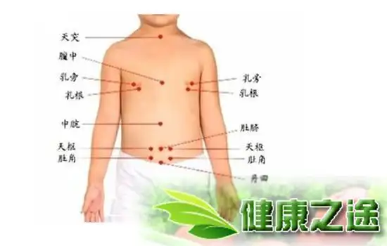 拔罐减肥的位置图 3个部位穴位拔罐瘦身
