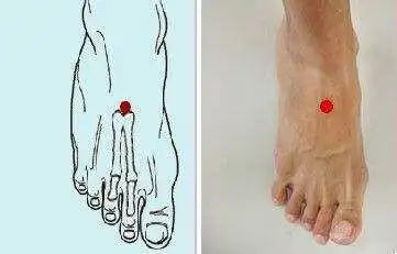 罗埠健康 足背动脉在哪?—— 家庭医生来帮你