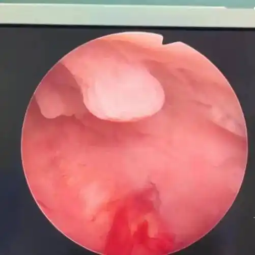 刘女士_女性_情况