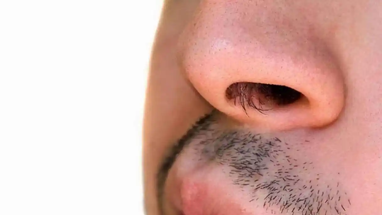 男的鼻毛多是怎么回事(男性的鼻毛为何会窜出来) - 医药经