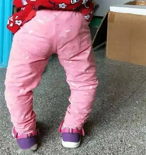 "妈妈,他们又在说我的腿是弯的"|磷聚力量·患者故事