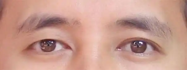 外眼角下垂面相 外眼角往下耷拉的女人面相-卜安居